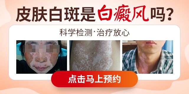 南京华肤医院怎么样？正规诚信有医德