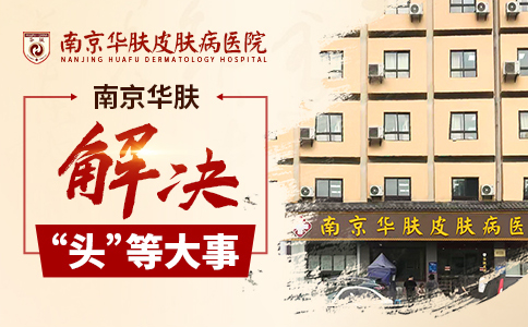 南京脱发治疗医院_南京治脱发哪家医院好