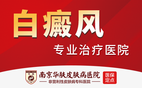 南京看白癜风去哪家医院
