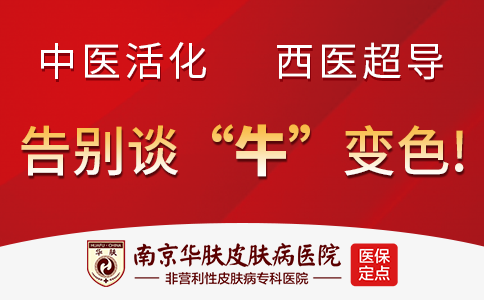 南京看银屑病医院怎么样