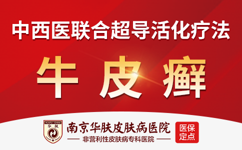 南京治疗银屑病哪里好