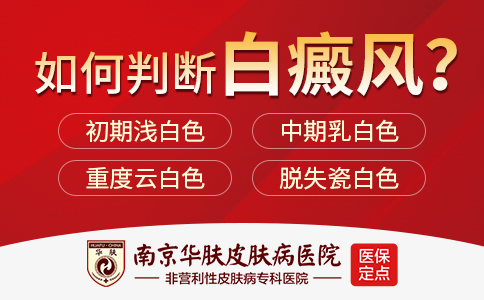 南京哪个医院治白癜风好